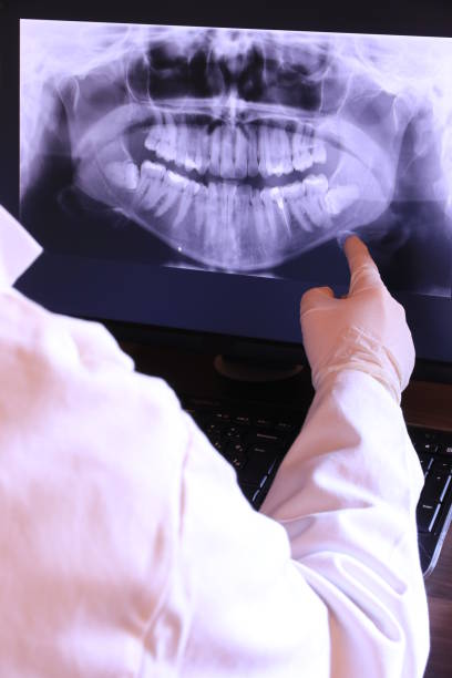 Best Knocked-Out Tooth (Avulsed Tooth) Treatment in Lee Acres, NM